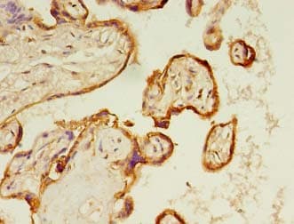 Polyclonal Rabbit anti-Human Calgizzarin / S100A11 Antibody (IHC)