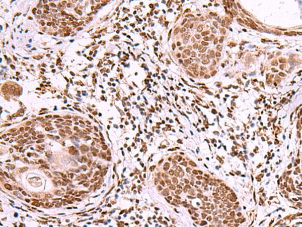 IRX1 Antibody