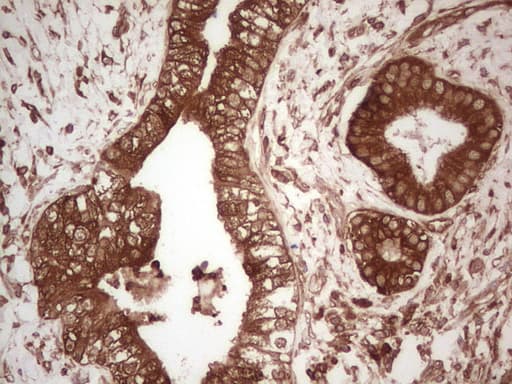 PKM2 Antibody (clone OTI11G10, Carrier-free)