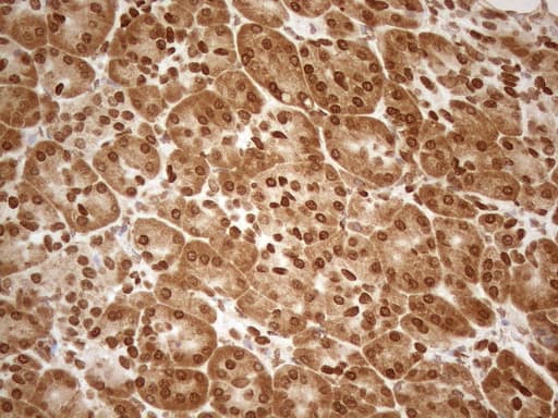 Monoclonal Mouse anti-Human ALOX5 / 5-LOX Antibody (clone OTI3F1, aa18-364, IHC, WB)