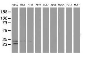 GSTT2 Antibody (clone OTI8A10)