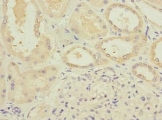 ATP6V0D1 Antibody
