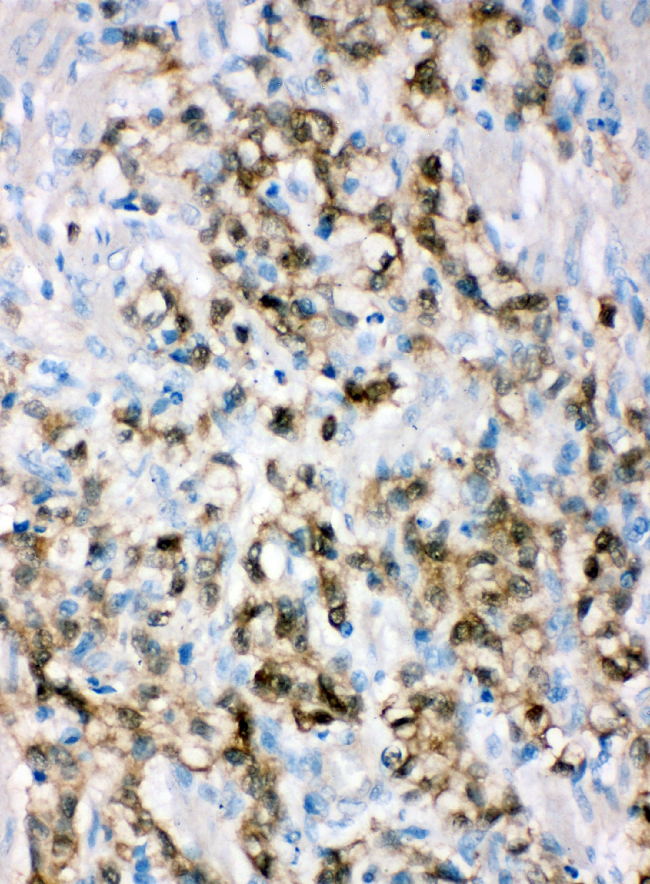 ALDH3A1 Antibody (aa440-453)