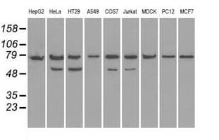 HSPA9 / Mortalin / GRP75 Antibody (clone OTI4A1)