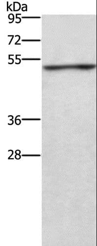 Polyclonal Rabbit anti-Human CKMT2 Antibody (IHC, WB)