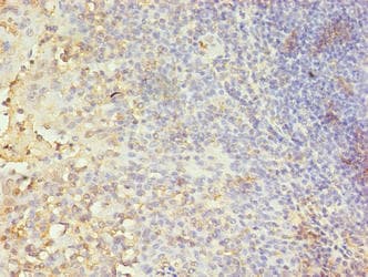 Polyclonal Rabbit anti-Human CA-VB / CA5B Antibody (IHC, WB)