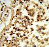 Polyclonal Rabbit anti-Human IL31 Antibody (aa13-40, IHC, WB)
