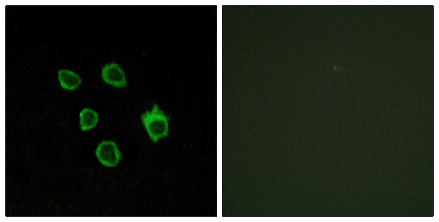 FZD5 / Frizzled 5 Antibody