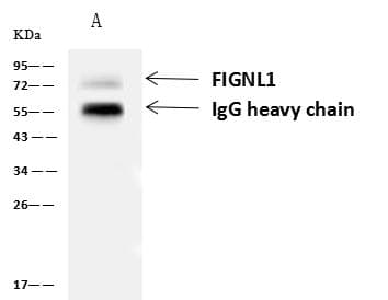 Polyclonal Rabbit anti-Human FIGNL1 Antibody (IHC, WB)