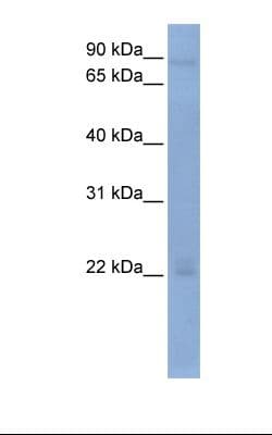 OAS2 Antibody (aa398-447)