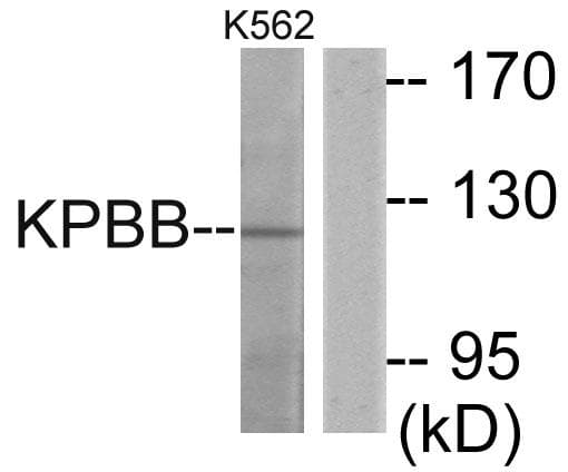 PHKB Antibody