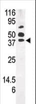PANK1 / PANK Antibody (aa332-360)