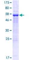 Human EMB/ Embigin Protein (Recombinant GST)