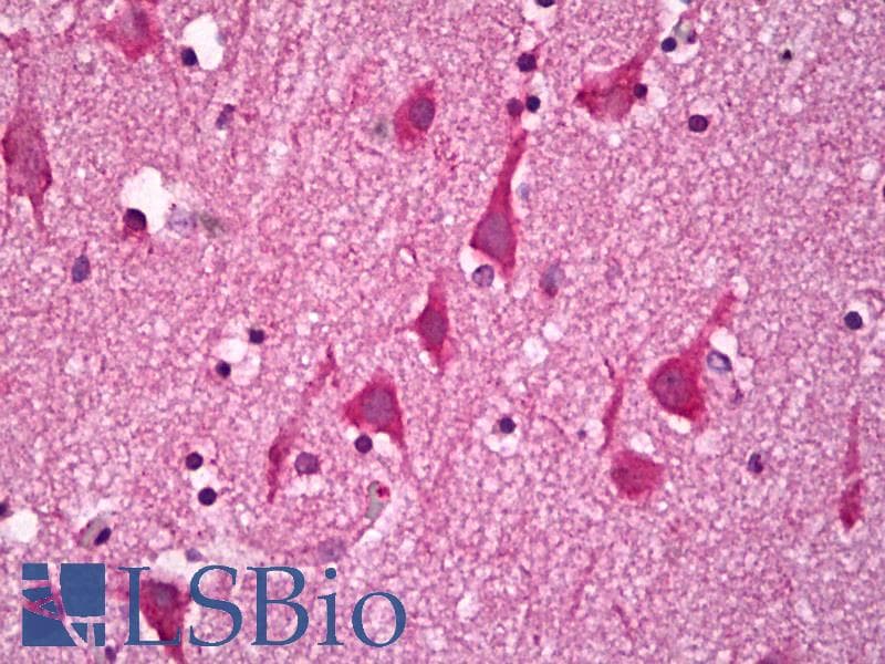IHC-plus™ GUCY1B3 Antibody