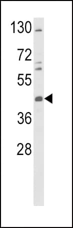 Polyclonal Rabbit anti-Human Tyrosine Aminotransferase Antibody (aa279-306, IHC, WB)