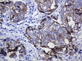 Monoclonal Mouse anti-Human CDH1 / E Cadherin Antibody (clone OTI2F9, IHC, WB)