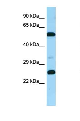 GPR37L1 Antibody (aa316-365)