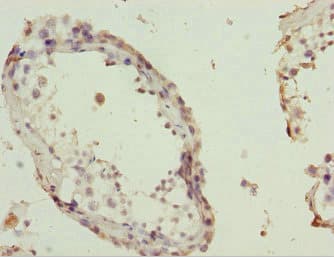 POC1A / SOFT Antibody