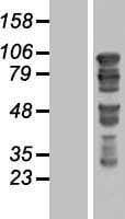 GTSE1 Protein (Over-Expression Lysate Myc-DDK (Flag))