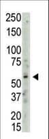PRMT3 Antibody (aa460-491)