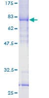 Human VPS72 Protein (Recombinant GST)