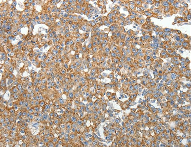 SIP1 Antibody