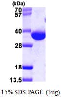 Human DECR1 Protein (Recombinant His)