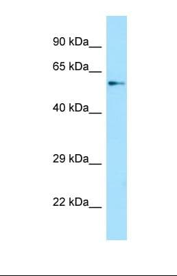 Polyclonal Rabbit anti-Human SPAG16 Antibody (aa161-210, WB)