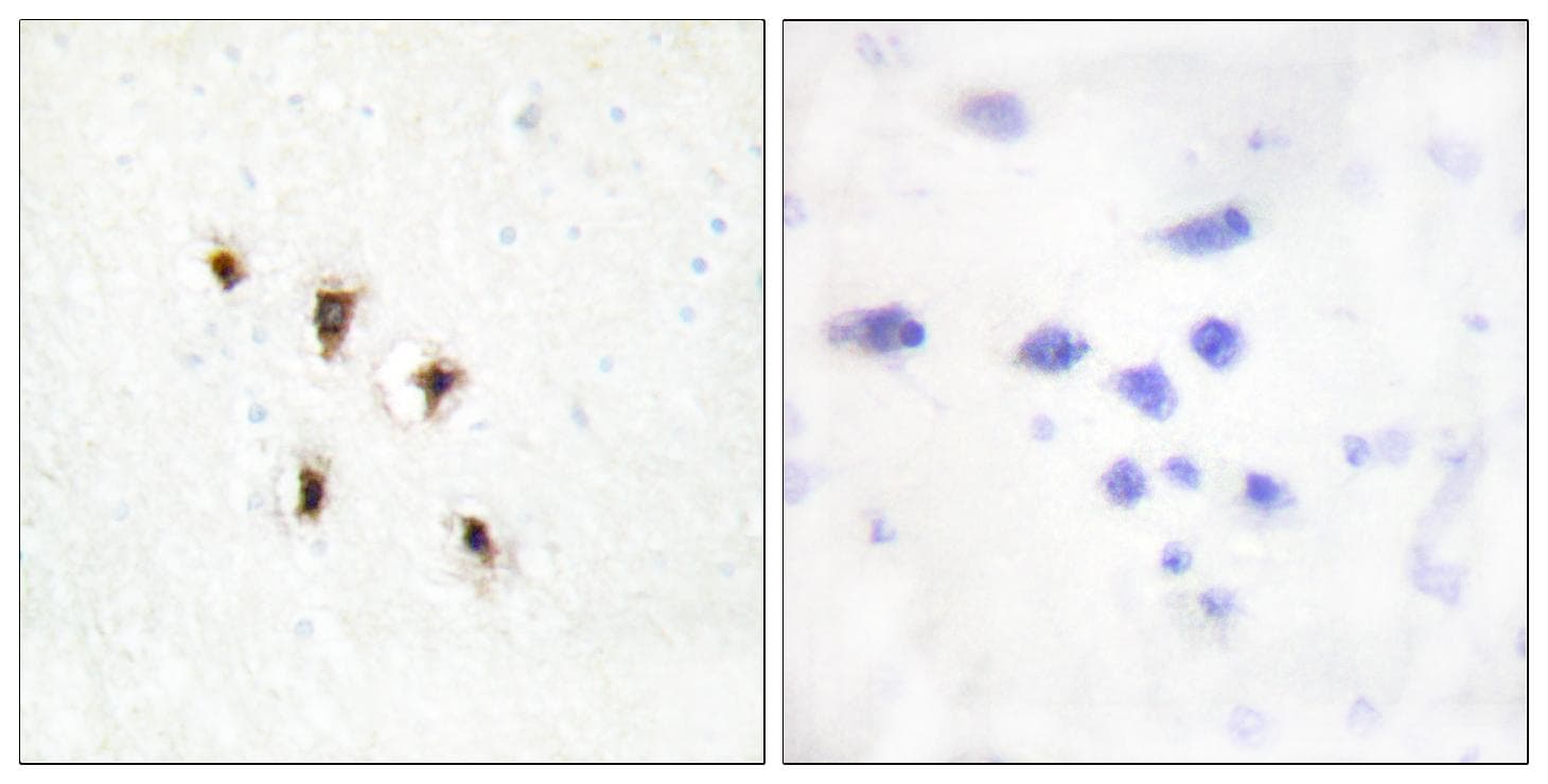 MVK Antibody