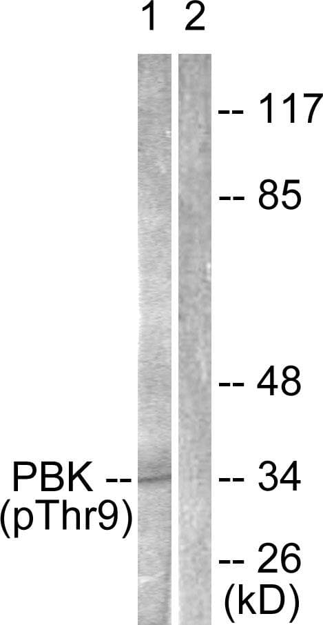 PBK / TOPK Antibody (phospho-Thr9)