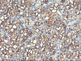 PFKP Antibody (clone OTI1D6)
