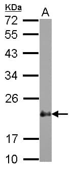Polyclonal Rabbit anti-Human CSRP2 Antibody (WB)
