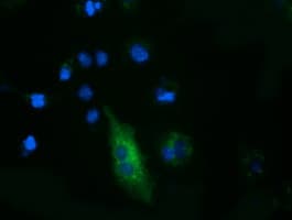 FSHB / FSH Beta Antibody (clone OTI2G9)