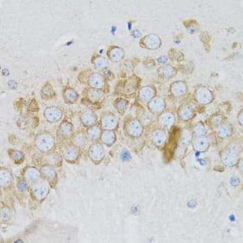 SIAH1 Antibody
