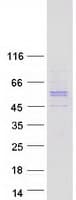 Human RGS11 Protein (Recombinant Myc-DDK (Flag))