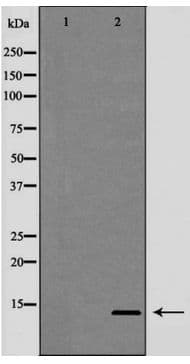 TFF2 / SP Antibody
