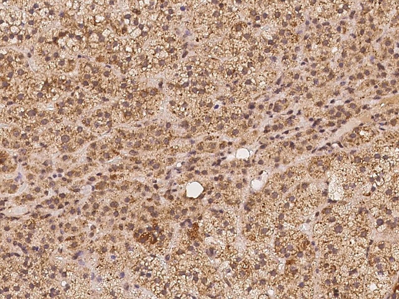 TNFSF14 / LIGHT Antibody