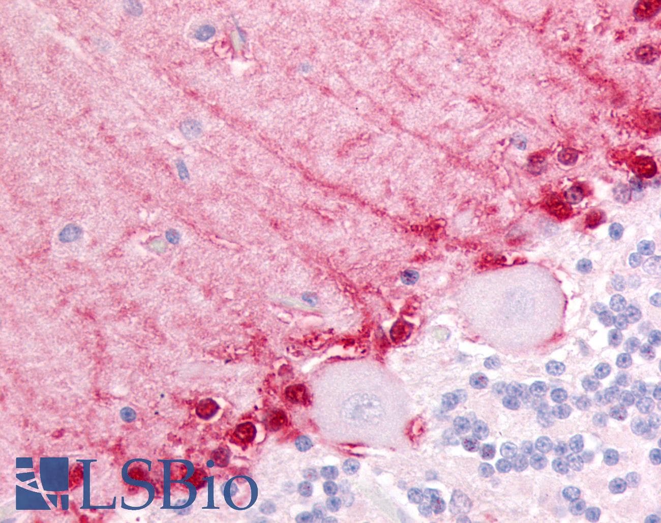 IHC-plus™ ADGRB3 / BAI3 Antibody (N-Terminus)