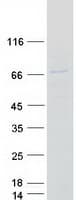 Human CCT6B Protein (Recombinant Myc-DDK (Flag))