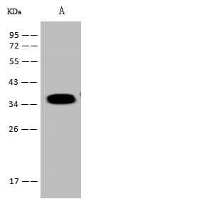 TNNT3 Antibody