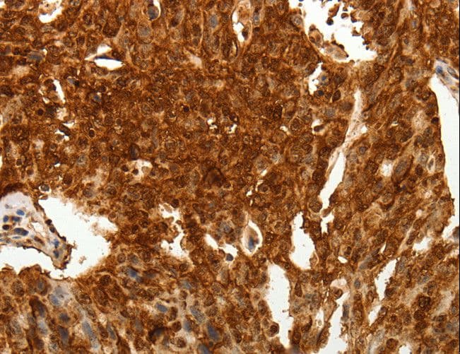 ODZ3 Antibody