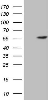 ABAT Antibody (aa29-323, clone OTI3F6)