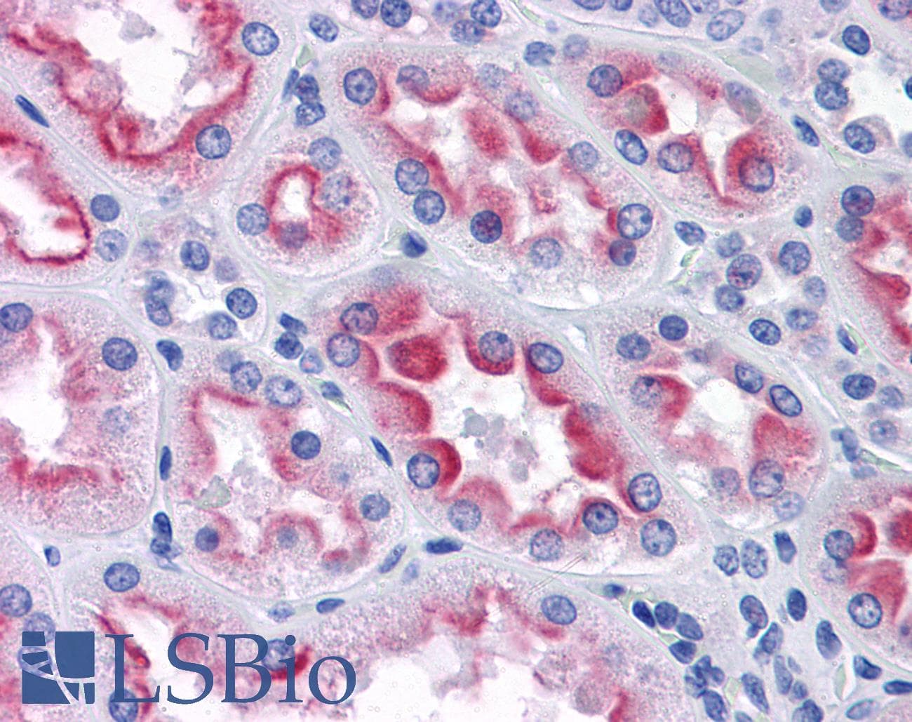 IHC-plus™ Monoclonal Mouse anti-Human AKR1B10 Antibody (clone 1A6, IHC, IF, WB)