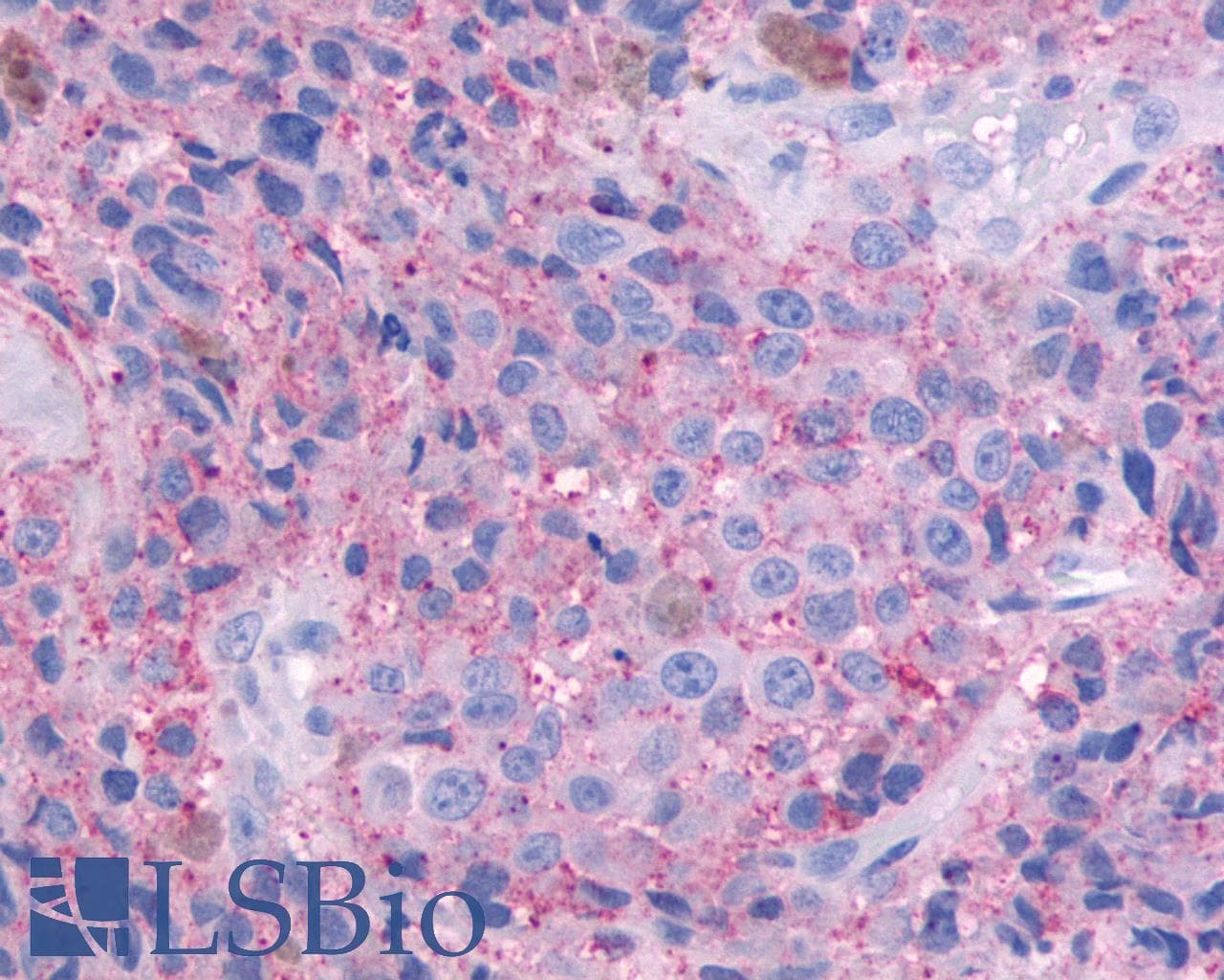 PathPlus™ Polyclonal Rabbit anti-Human OR51E1 Antibody (Cytoplasmic Domain, IHC)
