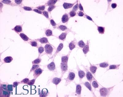 PathPlus™ Polyclonal Rabbit anti-Human GPR27 Antibody (N-Terminus, IHC)