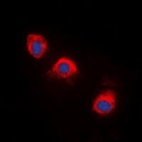 Polyclonal Rabbit anti-Human NTRK1 / TrkA Antibody (phospho-Tyr496, IHC, IF, WB)