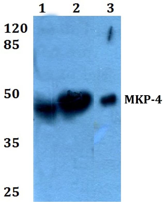 IHC-plus™ Polyclonal Rabbit anti-Human DUSP9 Antibody (aa140-184, IHC, IF, WB)