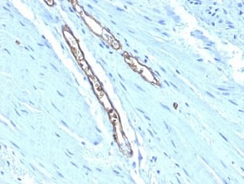 Blood Group A Antibody (clone HE-193)