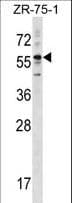 KRT3 / CK3 / Cytokeratin 3 Antibody (aa414-441)