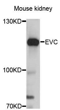 EVC / DWF-1 Antibody
